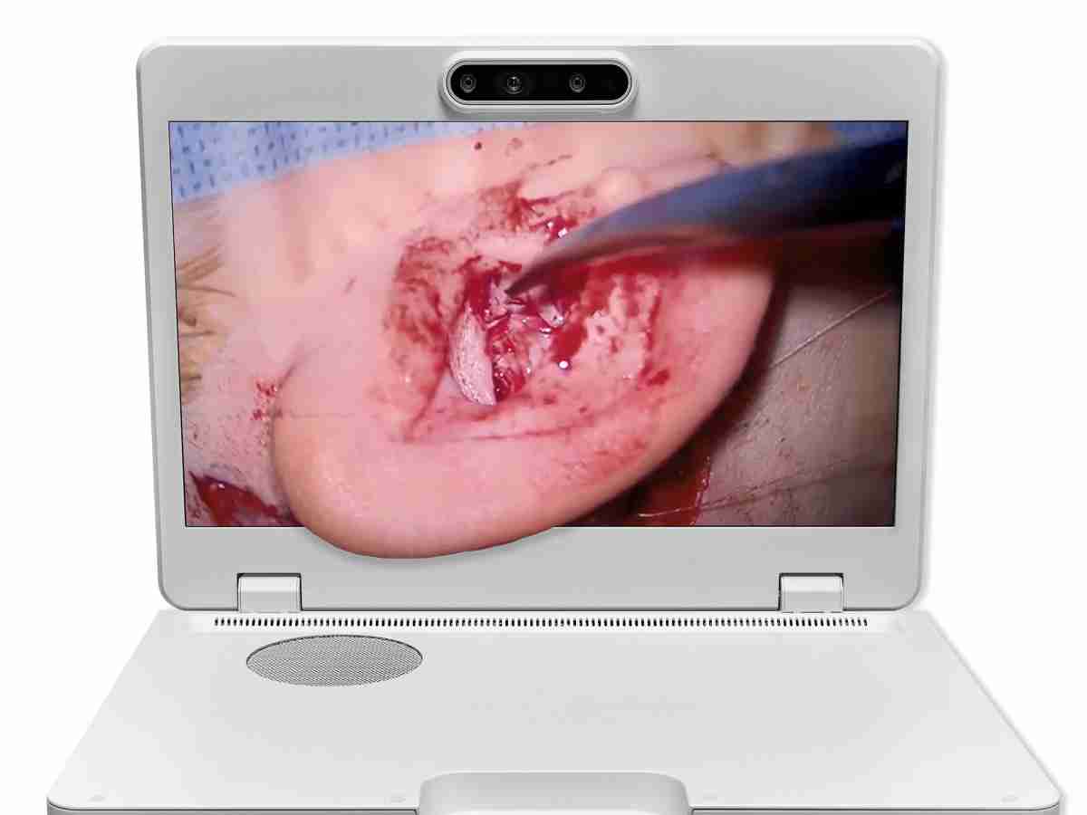 达擎之＂Heads-up 3D显微手术显示系统＂，，整合4K裸眼3D显示及眼球追踪系统，，具备快速追踪人眼移动位置功能，，，减轻医师长时间维持固定姿势的负担，，，，让医师能有更宽广清晰的3D立体视野及更舒适的姿势来执行手术。。。。